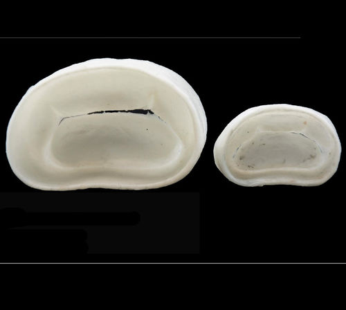 Modelo anatómico de válvula mitral - 3D Lifeprints UK Ltd - para cirugía robótica / de formación