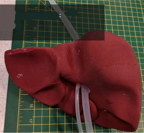 Modelo anatómico de hígado - 3D Lifeprints UK Ltd - para cirugía robótica / de formación
