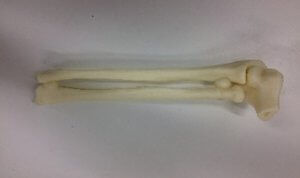 Modelo anatómico de hueso - 3D Lifeprints UK Ltd - de radio / de cúbito / de codo