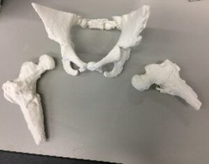 Modelo anatómico de hueso - 3D Lifeprints UK Ltd - de pelvis / de fémur / de cirugía