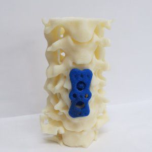 Modelo anatómico de la columna vertebral lumbar - 3D Lifeprints UK Ltd - para neurocirugía del raquis