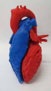 Modelo anatómico de corazón - 3D Lifeprints UK Ltd - para cirugía cardíaca
