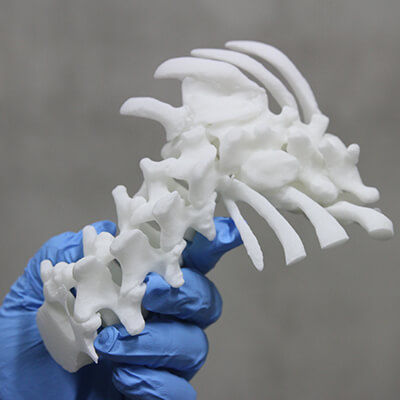 Modelo anatómico de columna vertebral - 3D Lifeprints UK Ltd - para escoliosis