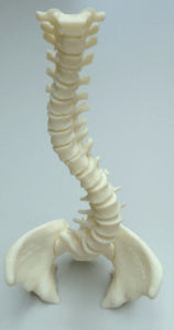 Modelo anatómico de columna vertebral - 3D Lifeprints UK Ltd - para escoliosis
