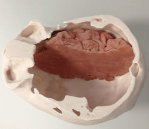 Modelo anatómico de cráneo - 3D Lifeprints UK Ltd - de cerebro / para craneotomía