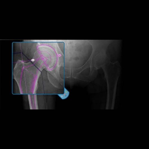 Software médico - OrthoView - Materialise UK - de análisis / de gestión / de planificación