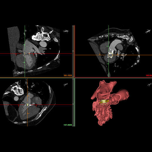 Software de visualización 3D - Mimics Enlight - Materialise UK - médico / de anatomía / TDM