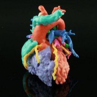 Software de impresión 3D - HeartPrint - Materialise UK - médico / de anatomía / de planificación