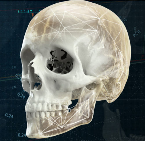 Software de visualización 3D - CMF - Materialise UK - médico / de hospital / clínico