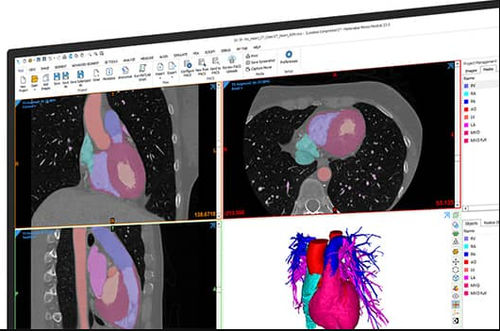 Software visualizador - Mimics  - Materialise UK - médico / clínico / de gestión