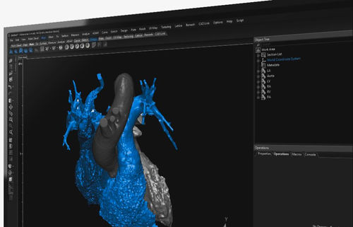 Software de visualización 3D - 3-matic  - Materialise UK - médico / de anatomía / de diseño