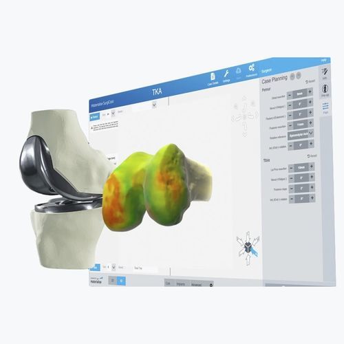 Software de visualización 3D - Materialise UK - de planificación / quirúrgico / preoperatorio
