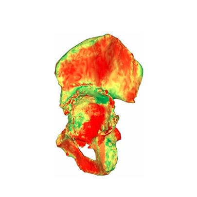 Software médico - aMace - Materialise UK - clínico / TDM / para cirugía