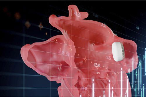 Software visualizador - Enlight LAAO - Materialise UK - de planificación / de intercambio / de impresión 3D