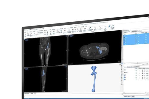 Software de medición - Mimics - Materialise UK - médico / clínico / de anatomía