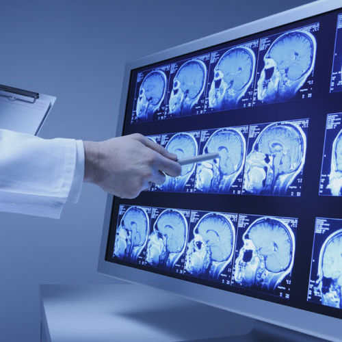 RIS de análisis - SinoVision - para imágenes médicas / cardíaco / de hospital