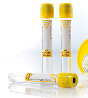 Tubo de extracción de laboratorio - VACUSERA  - Disera Tıbbi Malzeme Loj. San.Tic.A.S. - cilíndrico / de orina / para extracción de muestras