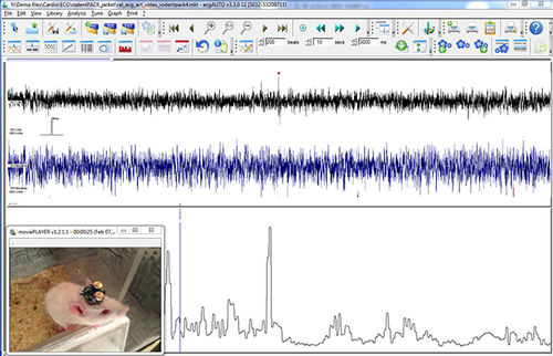 Software médico - EEG+ - emka TECHNOLOGIES - para EMG / cardiovascular / neurológico