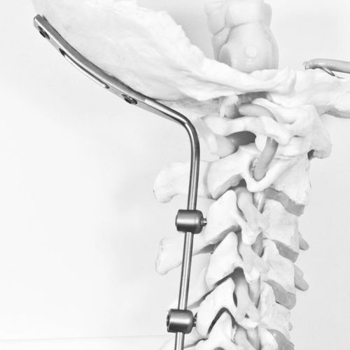 Sistema de osteosíntesis occipitocervical - J.O.C. - NEURO FRANCE Implants - vía posterior / para adulto