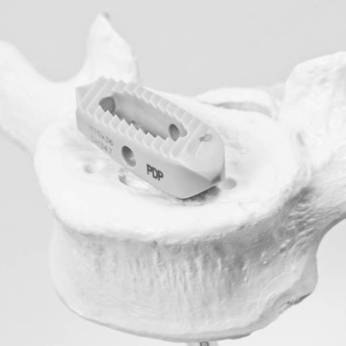 Caja intersomática toracolumbar - P.D.P - NEURO FRANCE Implants - vía posterior / vía transforaminal / de PEEK