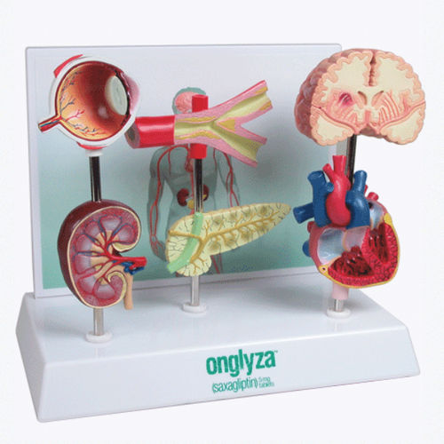 Modelo anatómico de diabetes - A575 - Apple Biomedical - de corazón / de arteria / de ojo