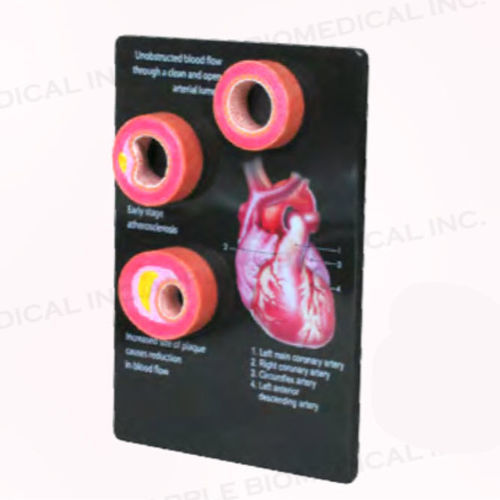 Modelo anatómico de arteria - A520 - Apple Biomedical - de formación / rosa / de mano