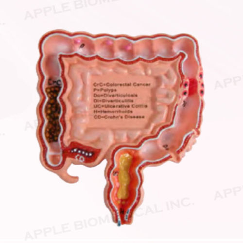 Modelo anatómico de colon - A345 - Apple Biomedical - de gastroenterología / de formación / rosa