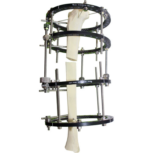 Fijador externo para tibia - pt-BR - Selaz - circular / para adulto