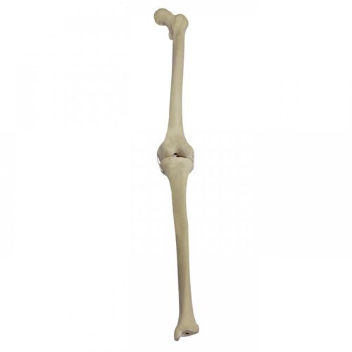 Modelo anatómico de hueso - 2040BEESP - Nacional Ossos - de rodilla / de tibia / de fémur