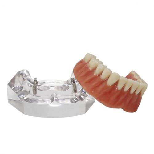 Modelo anatómico de dentadura - 9566  - Nacional Ossos - de implantología / de prótesis dental / de formación