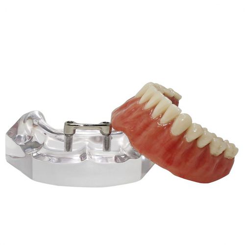 Modelo anatómico de dentadura - 9567  - Nacional Ossos - de implantología / de prótesis dental / de formación