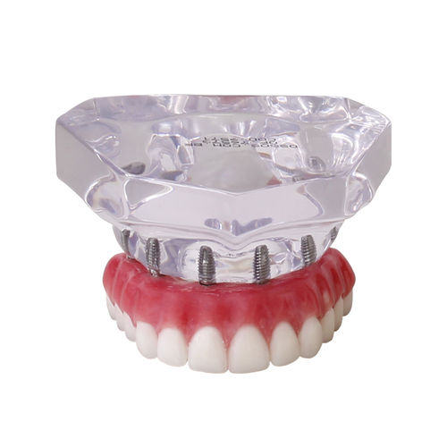 Modelo anatómico de dentadura - 9571  - Nacional Ossos - de implantología / de prótesis dental / de formación