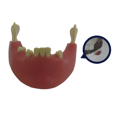 Modelo anatómico de mandíbula - 4401G-02 - Nacional Ossos - gingival / de cirugía / para extracción dental