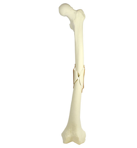 Modelo anatómico de hueso - 9703 - Nacional Ossos - de fémur / para cirugía ortopédica / de formación