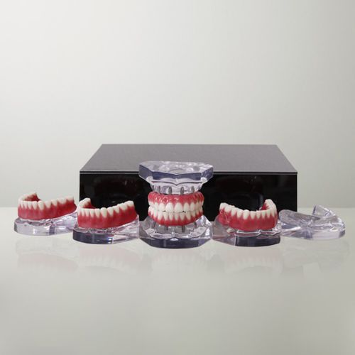Modelo anatómico de mandíbula - 9768 - Nacional Ossos - de maxilar / de dentadura / para cuidados dentales