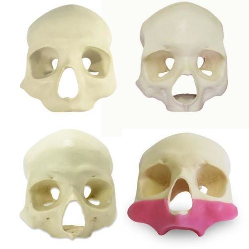 Modelo anatómico de cráneo - 9014G ALL-ON-4 - Nacional Ossos - de seno / para odontología / gingival