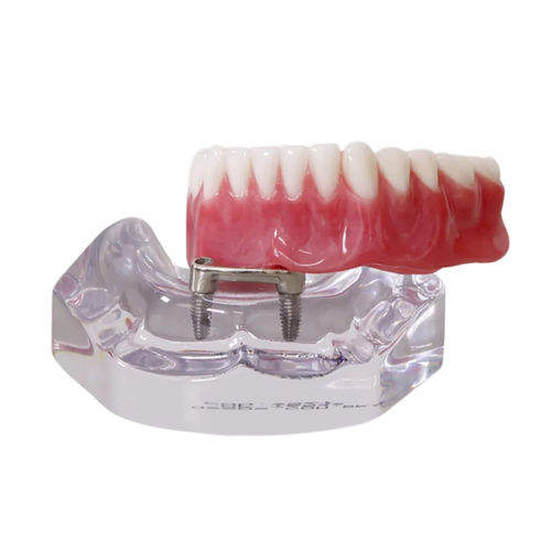 Modelo anatómico de dentadura - 9567  - Nacional Ossos - de implantología / de prótesis dental / de formación