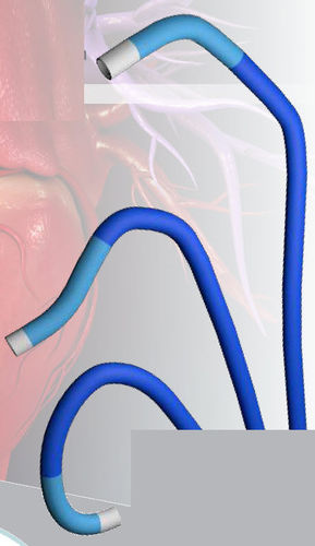 Catéter de guiado - Tracer™  - MEDAS INC - cardíaco / 6 FR / 7 FR