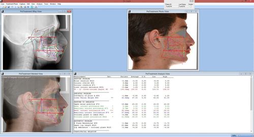 Software de análisis cefalométrico - Dr. Ceph - For Your Imaging Technologies - para imágenes médicas / ortodóntico / quirúrgico