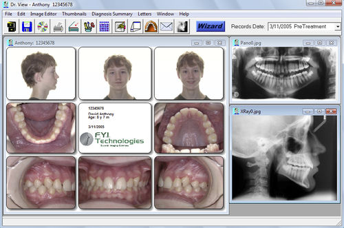 Software de análisis cefalométrico - Dr. View - For Your Imaging Technologies - ortodóntico