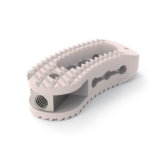 Caja intersomática toracolumbar - Twisty  - NORMMED Medical Devices - vía transforaminal / de PEEK