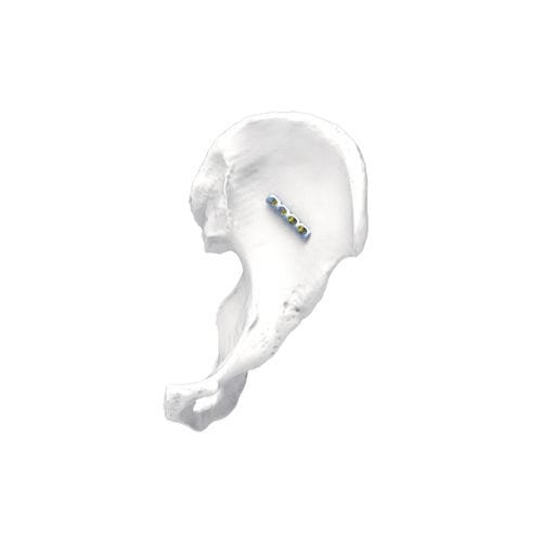 Placa de compresión para pelvis - PNM1009 - NORMMED Medical Devices - bloqueada / metálica