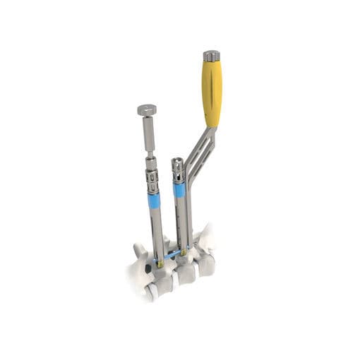 Sistema de posicionamiento de tornillos pediculares mínimamente invasivo - ARES  - NORMMED Medical Devices