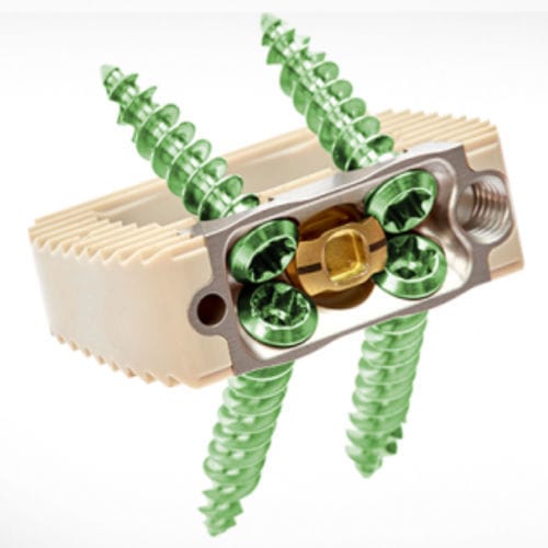 Caja intersomática lumbar - Spineology - vía anterior / de PEEK