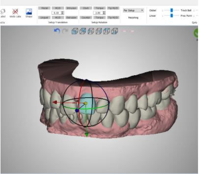 Software ortodóntico - PLAN - VERSION 5.0 - Orchestrate Orthodontic Technologies - de control / de diseño / Windows