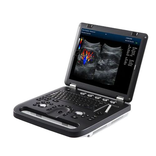 Ecógrafo portátil - M60  - Hunan Fude Technology - para ecografía polivalente / blanco y negro / doppler-color