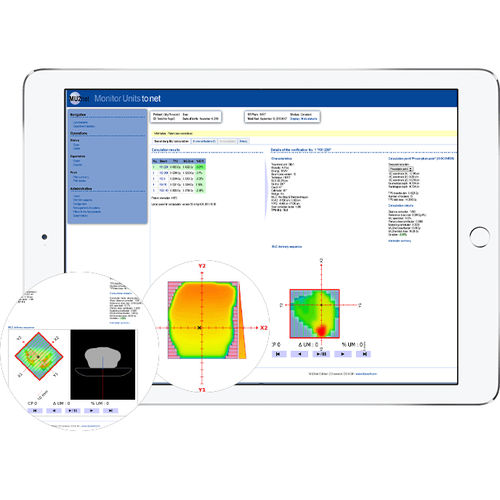 Módulo de software de planificación de tratamiento - MU2net - DOSIsoft - para radioterapia