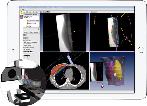 Módulo de software de monitorización de dosis de radiación - EPIgray® - DOSIsoft - para radioterapia