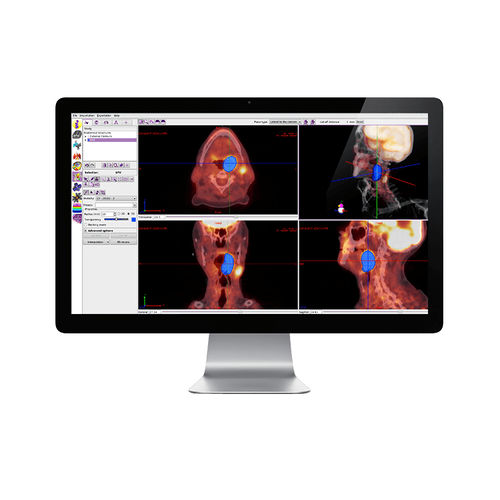 Software de detección de contornos - IMAgo - DOSIsoft - para radioterapia