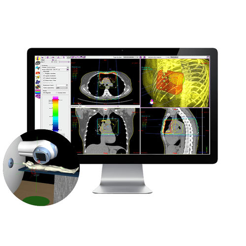 Software de simulación - SIMAgo - DOSIsoft - para radioterapia